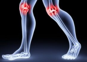 The reasons for developing knee artrosis